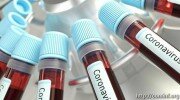 В Южной Осетии за сутки коронавирус подтвержден еще у 5 жителей