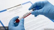 За сутки не выявлено: Югосетпотребнадзор призывает соблюдать правила, действующие при пандемии коронавируса