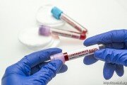 Третьи сутки в Южной Осетии нет новых случаев заболевания коронавирусом, все тесты отрицательные