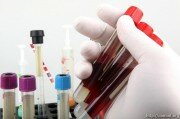Новых нет: в Южной Осетии порядка 70 тестов на коронарирус показали отрицательный результат
