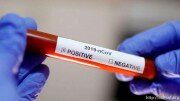 В Южной Осетии выявили два новых случая заболевания коронавирусом у граждан, вернувшихся из Северной Осетии