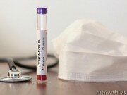 За сутки в Южной Осетии проведено 70 тестов: новых случаев заболевания коронавирусом не выявлено
