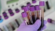 (+) 9 новых случаев заболевания коронавирусом в Южной Осетии за сутки